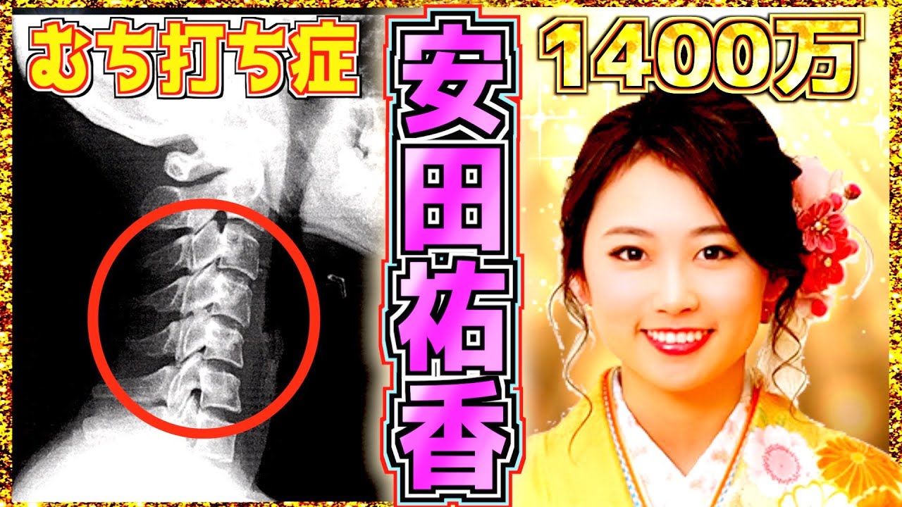 【安田祐香】首の悲劇と4kg激ヤセにも負けないエリート超美少女 ゴルフ