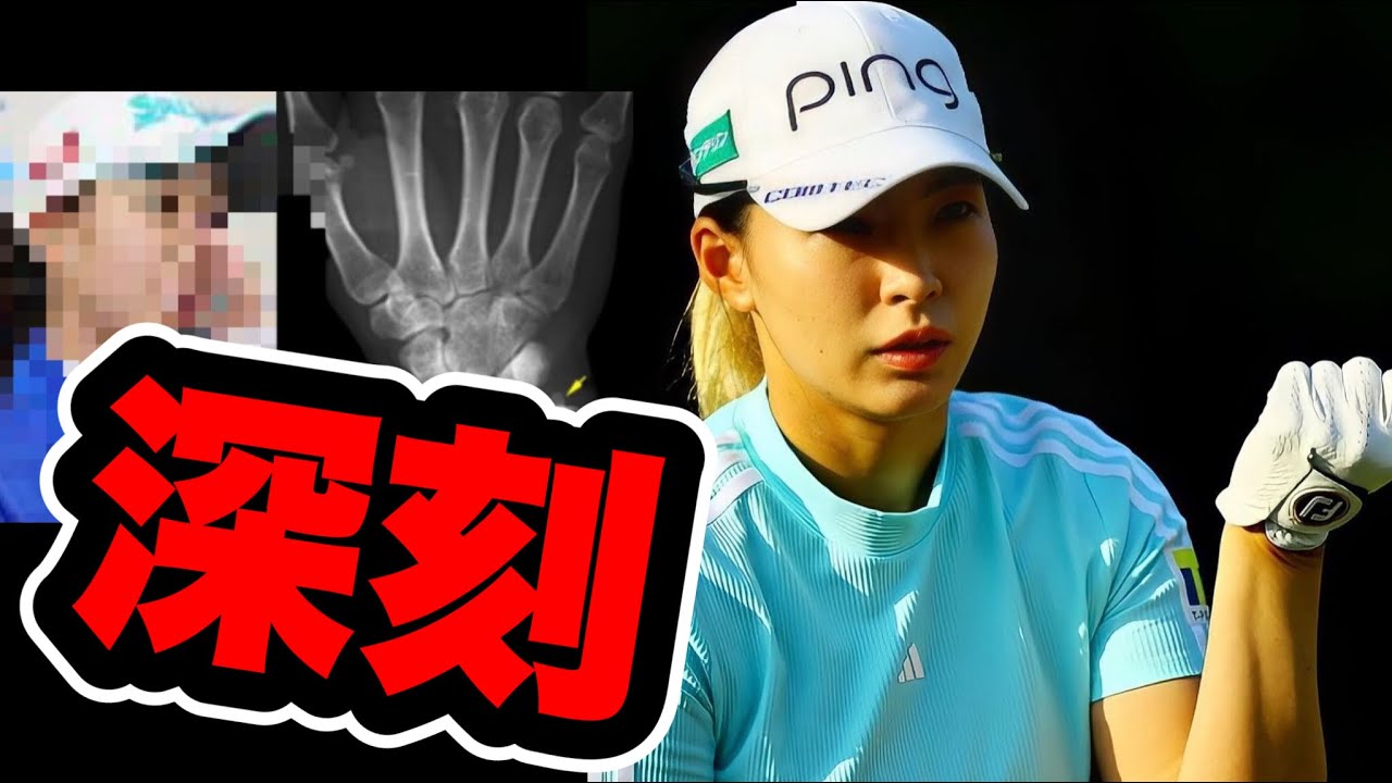 渋野日向子ブリヂストンレディスリタイアしたほうがいい深刻な状況