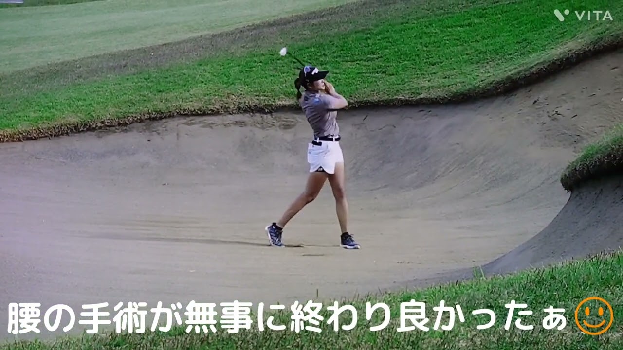 原 英莉花プロ💕腰の手術が無事に終わり本人いわくエイリアンみたいな骨を除去‼️ツアー復帰が待ち遠しいなぁ⤴️