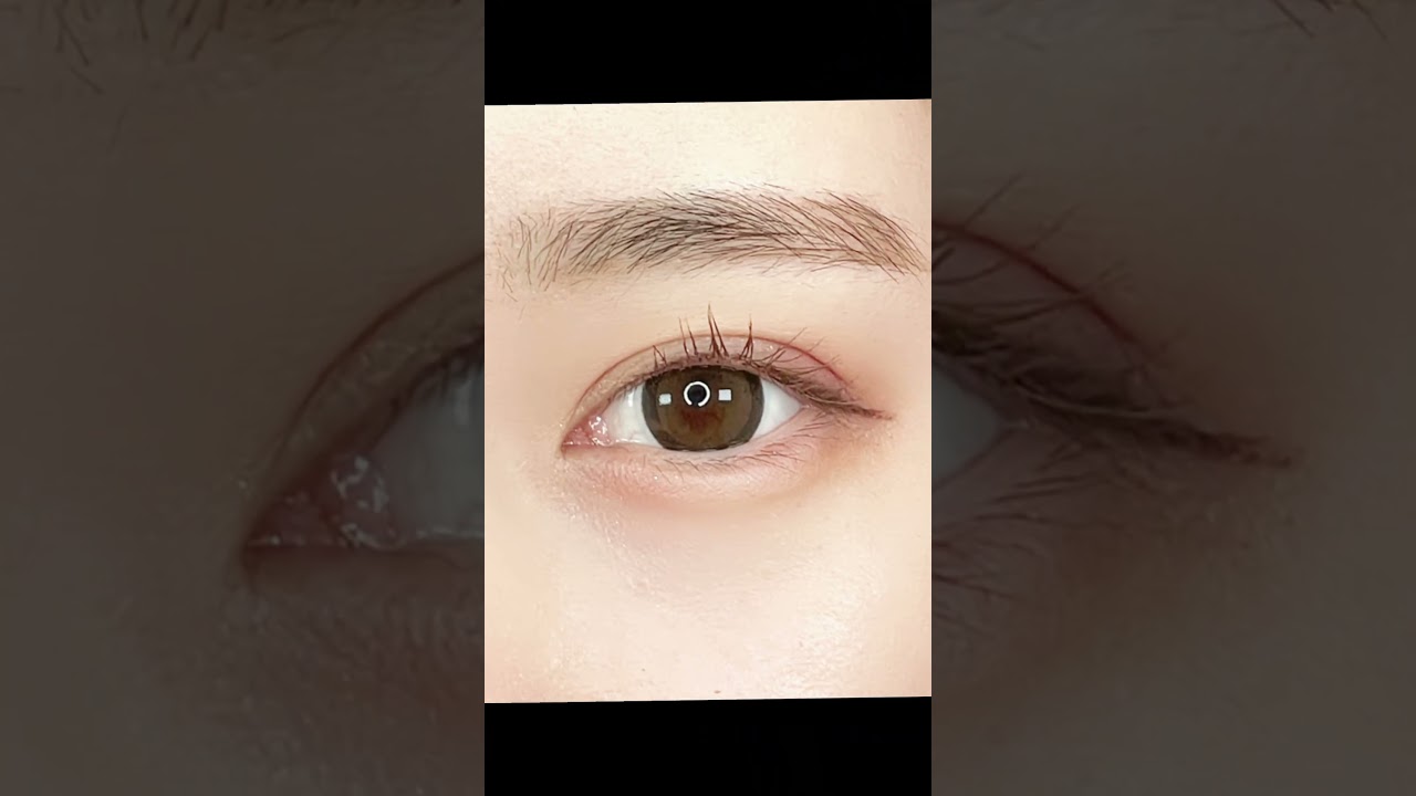 【二重整形】#tcb #shorts #doubleeyelid