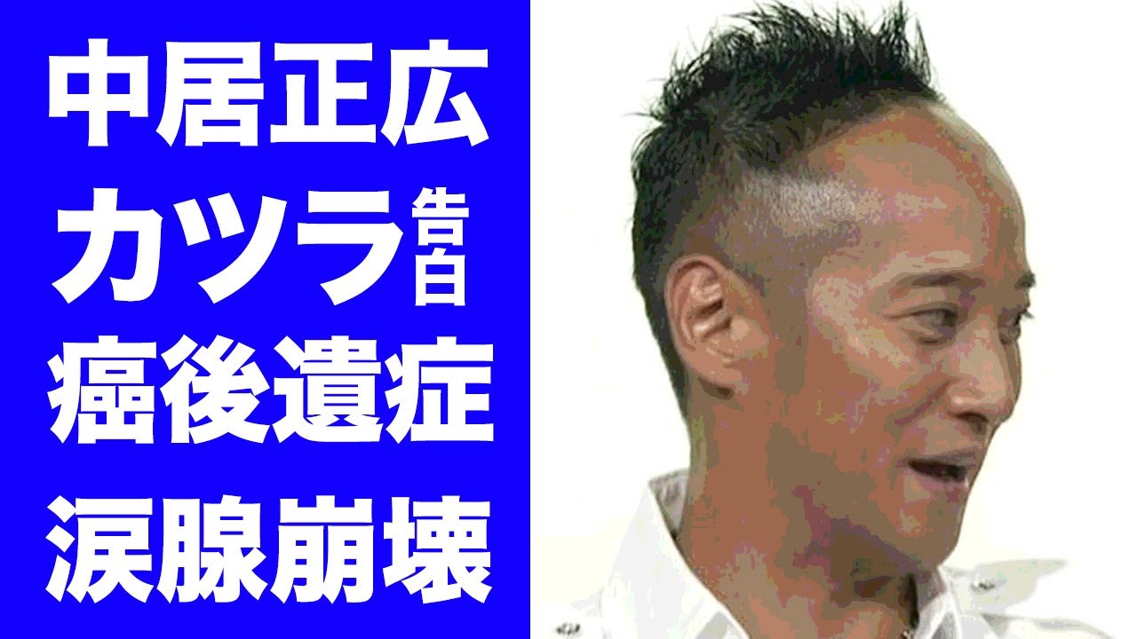 【衝撃】中居正広がカツラを被っていたことを告白...ガン闘病の後遺症に涙が零れ落ちた...多くの人気番組のＭＣを務める元アイドルが今尚"病名"を隠し続ける理由がヤバすぎた...