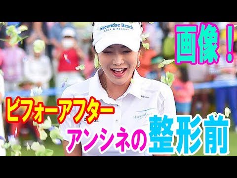 アンシネの整形前ビフォーアフター画像！すっぴんもスゴイ！・・・【韓国 報道 SP】