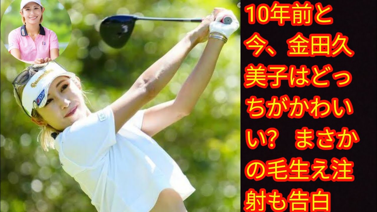 10年前と今、[Japan news]金田久美子はどっちがかわいい？ まさかの毛生え注射も告白