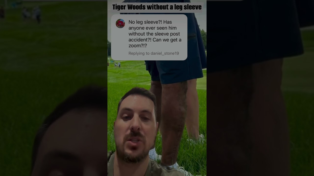 Tiger Woods leg scar! 😮