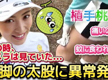 【植手桃子】痛いの❓️蚊に食われたの❓️美脚の太股に異常発生⁉️😱💦【女子プロゴルファー】