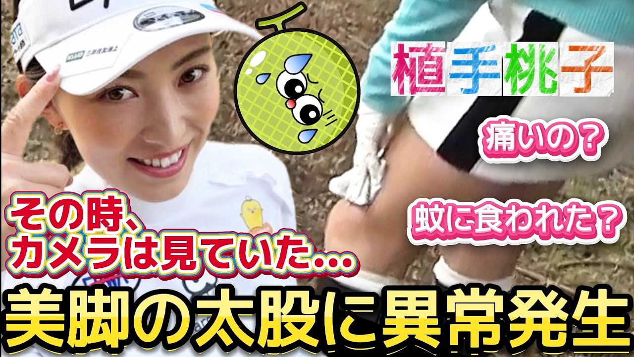 【植手桃子】痛いの❓️蚊に食われたの❓️美脚の太股に異常発生⁉️😱💦【女子プロゴルファー】
